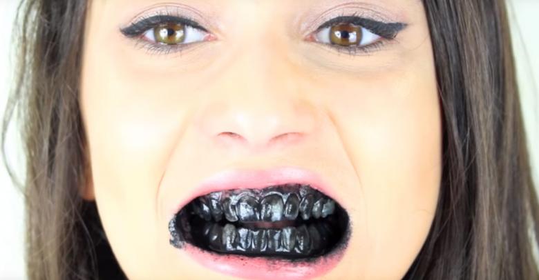 Blanquear los dientes con carbón activado, la opinión de los dentistas.